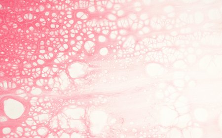 How high blood pressure turns healthy cells into foam cells.