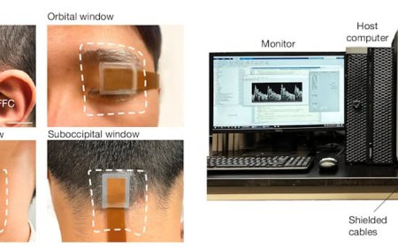 Ultrasound patch continuously tracks blood flow in the brain